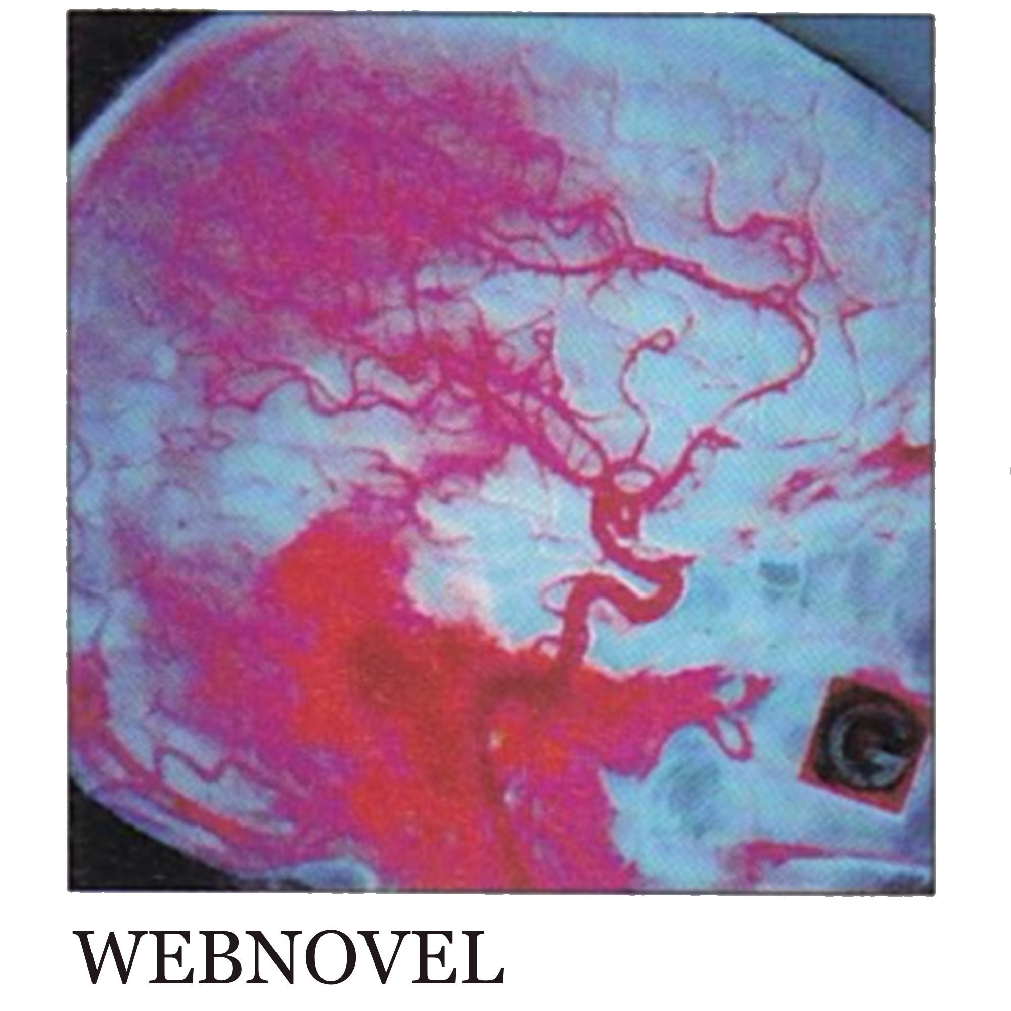webnovels